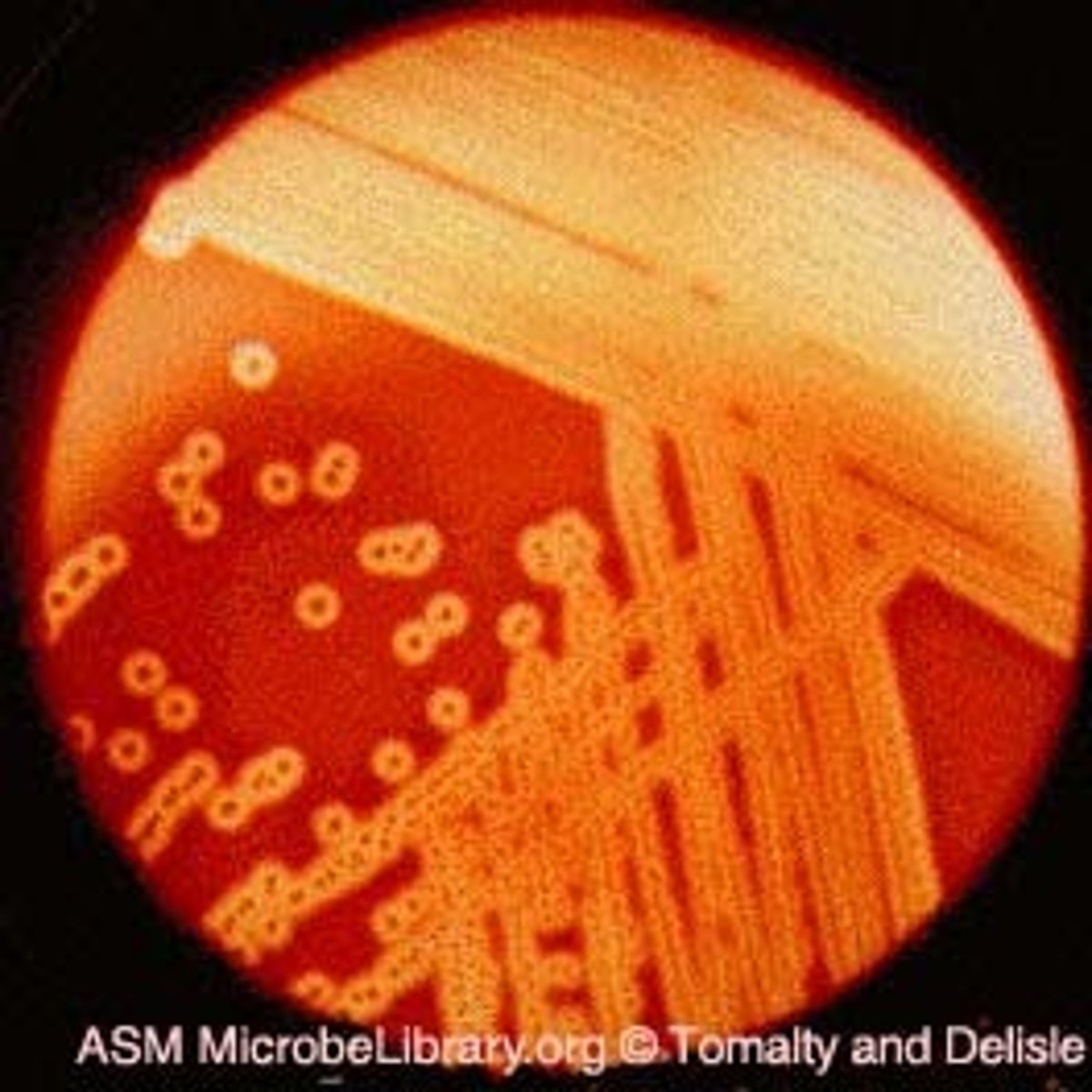 <p>Complete lysis of red blood cells.</p><p>Some bacteria produce hemolysin enzymes which break down hemoglobin in RBCs leading to lysis of RBCs.</p><p>E.g., GBS is a beta-hemolytic bacteria</p>