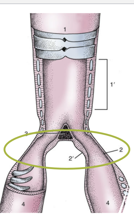 <ul><li><p><span style="color: #f7f7f7">No vocal folds in the larynx – all vocalization occurs in the Syrinx</span></p></li><li><p><span style="color: #f7f7f7">Terminal part of the trachea + first parts of the primary bronchi</span></p></li><li><p><span style="color: #f7f7f7">Initial parts of the bronchi are membranous (no cartilage), and will make sound when they vibrate</span></p></li><li><p><span style="color: #f7f7f7">Certain species, like songbirds, have more intricate syringeal musculature</span></p></li><li><p><span style="color: #f7f7f7">Parrots actually have very few syringeal muscles, compared to songbirds</span></p></li><li><p><span style="color: #f7f7f7">Common location for foreign body obstruction</span><span style="color: #f7f7f7"><br></span></p></li></ul><p></p>