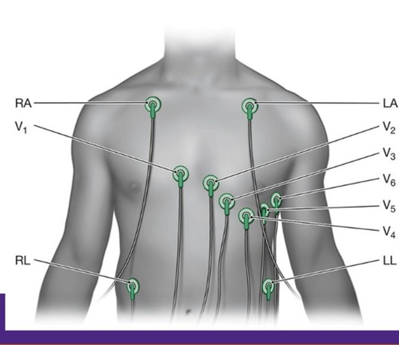 <p>Group 1 is oriented in the frontal plane (I, II, III, aVR, aVL, aVF) and Group 2 is oriented in the horizontal plane (V1, V2, V3, V4, V5, V6).</p>