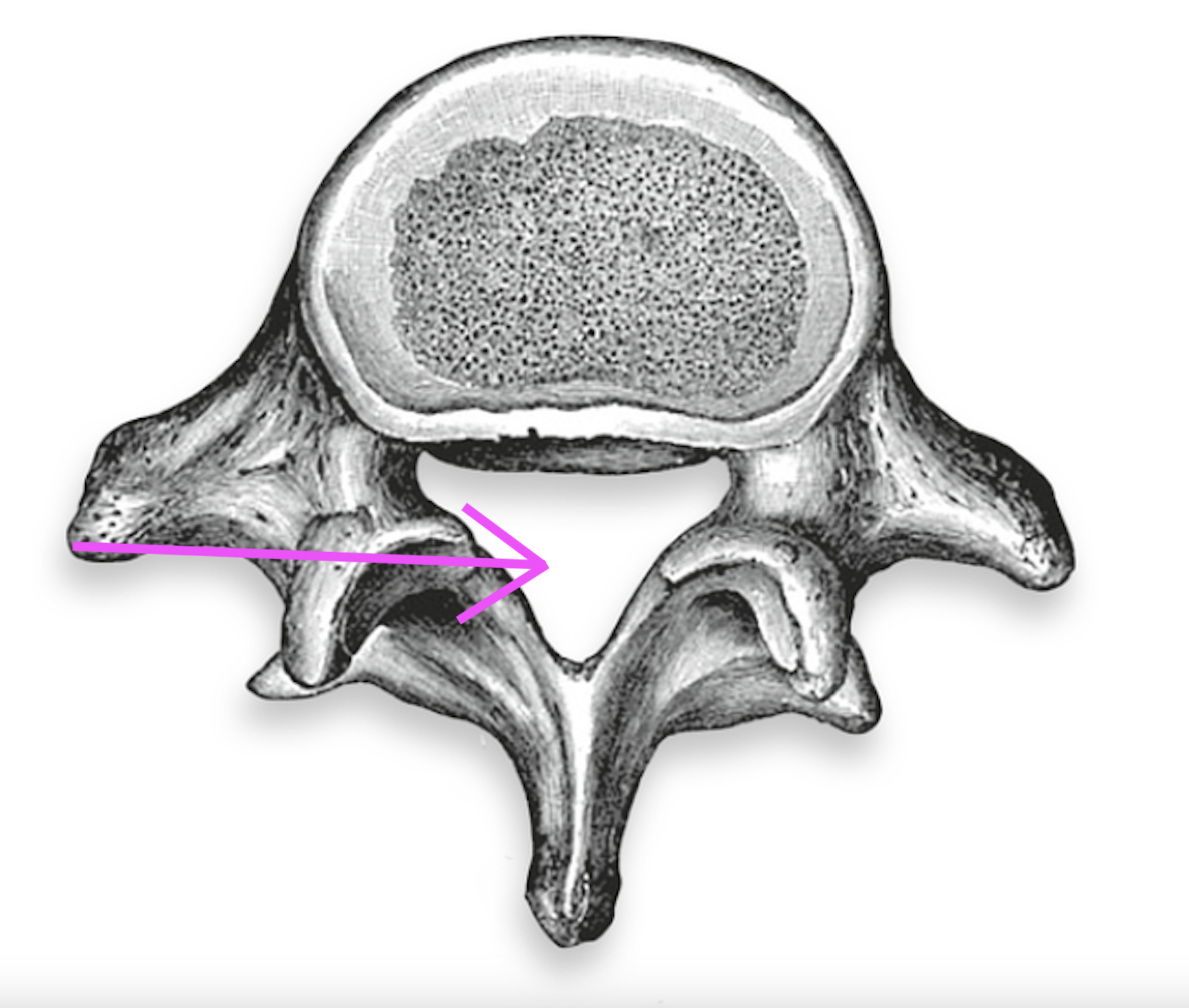<p>What part of the vertebrae is this?</p>