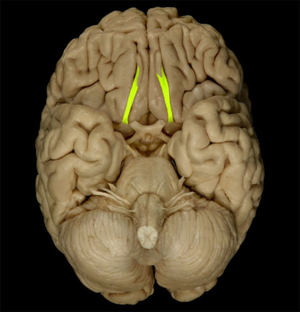 <p>olfactory nerve</p><p>passageway: cribriform foramina of ethmoid bone (to olfactory bulbs)</p><p>function: detects sensation of smell</p>
