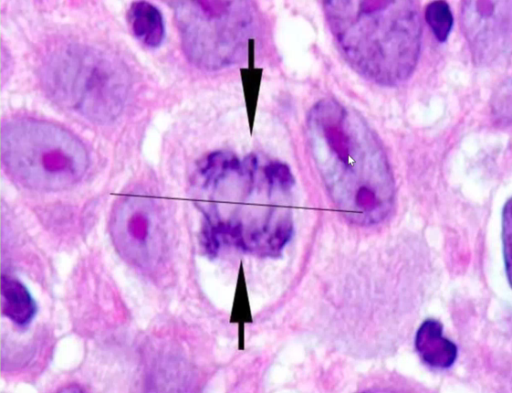 <p>Identify the stage of mitosis</p>