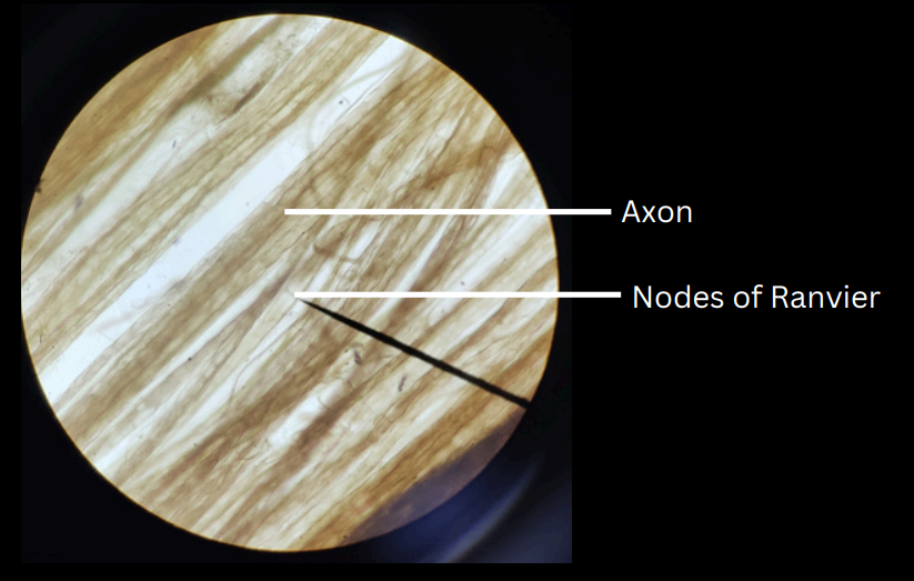 <p>fibers in the nerve</p>