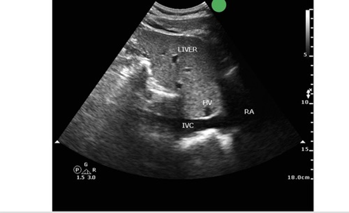 <p>what view is this?</p>