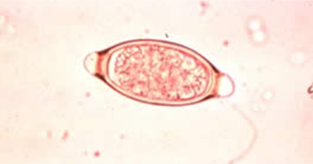 <p>The common name for this parasite is the pig whipworm. Please name this parasite.</p>