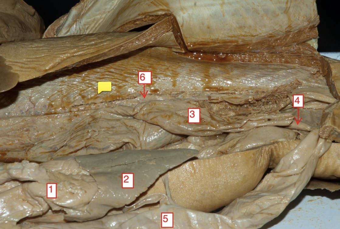 <p>female spiny dogfish- (4)</p>