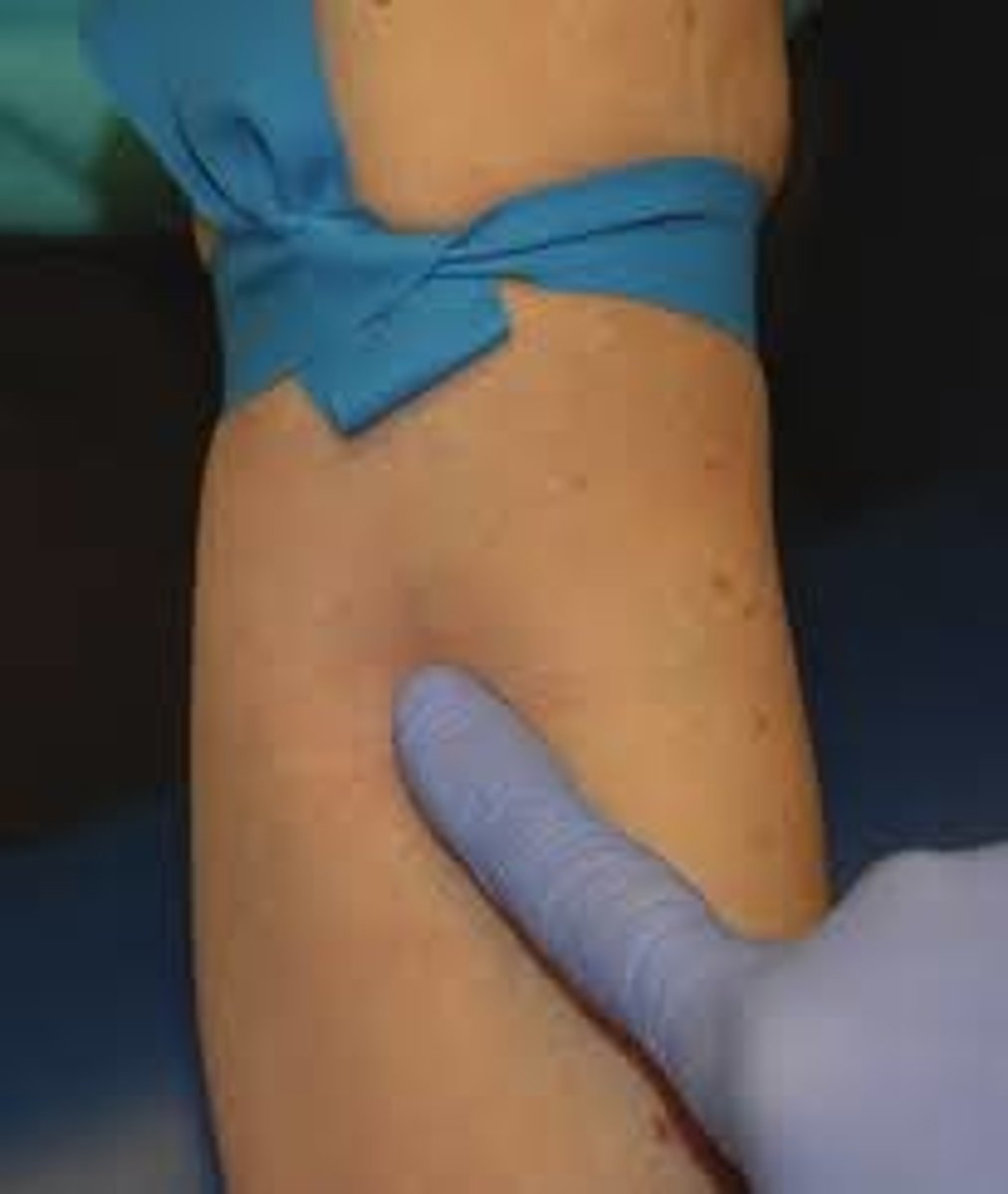 <p>- 2-4 inches above wound</p><p>- Pad/dressing over area to be torqued</p><p>-Apply tourniquet / tighten enough to control bleeding</p><p>-document time and date of tightening</p>