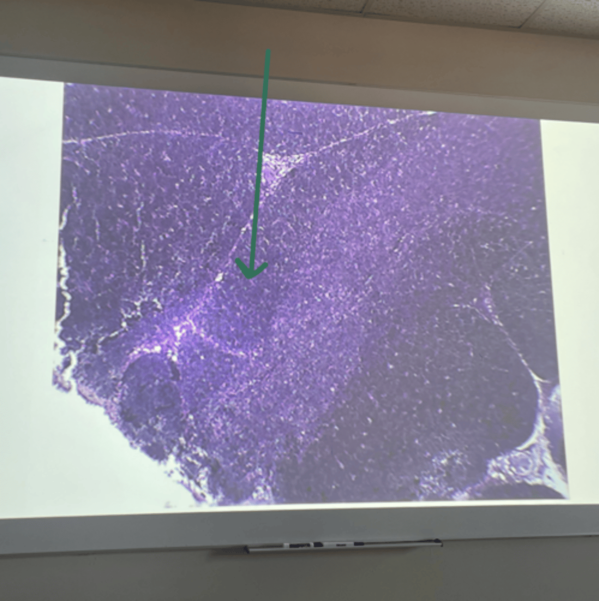 <p>gland and structure</p>