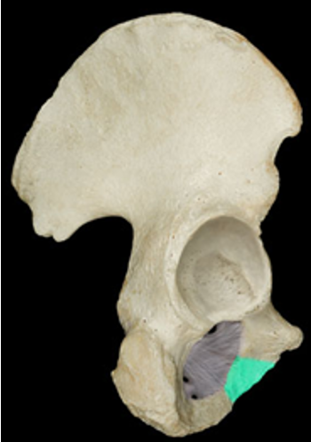 <p>continuation of the ischial ramus around the obturator foramen</p>