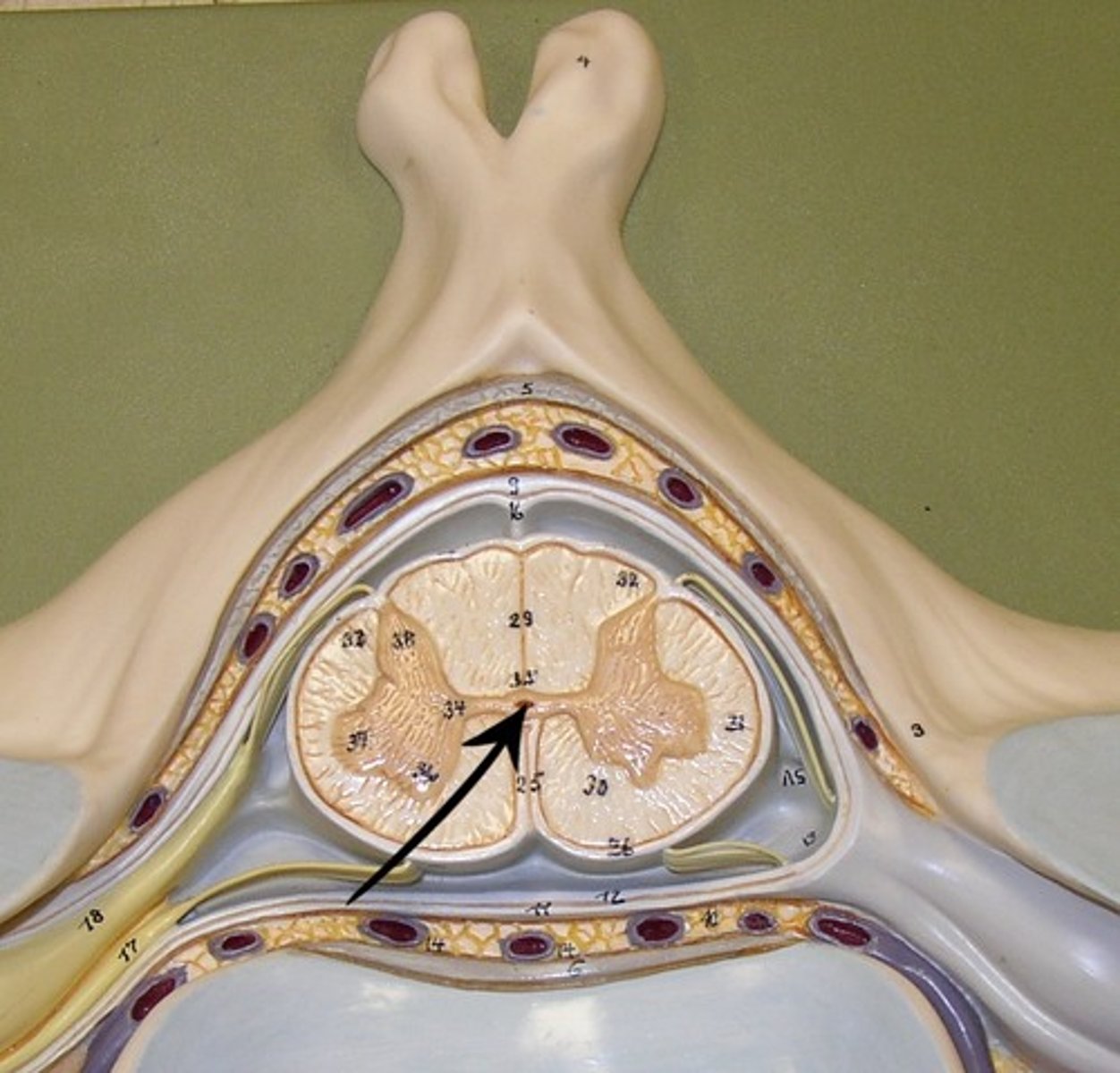 <p>The tube in the spinal cord that contains cerebrospinal fluid</p>