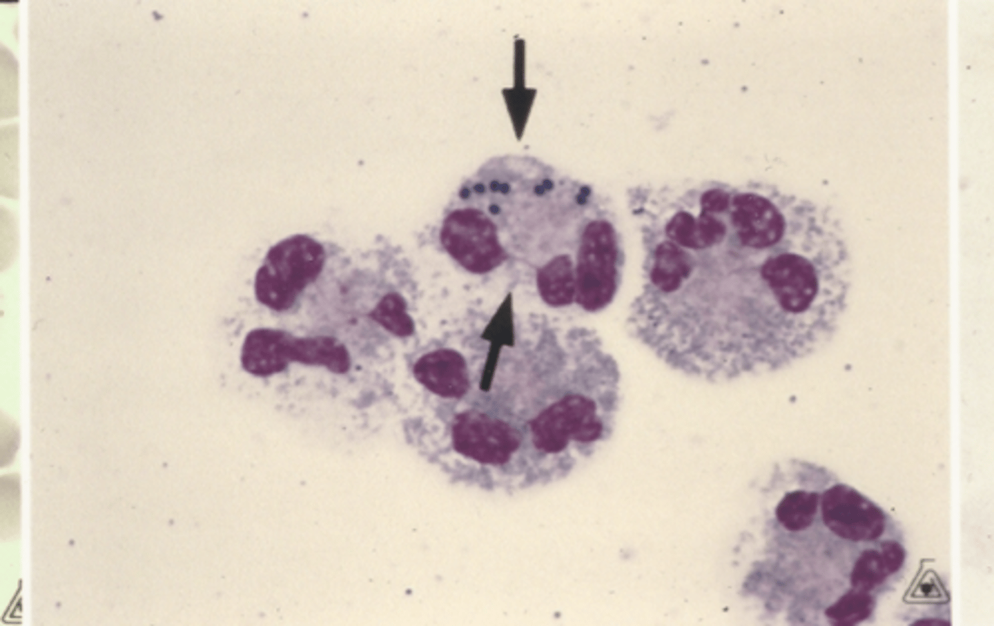<p>Identify the cells in this body fluid</p>