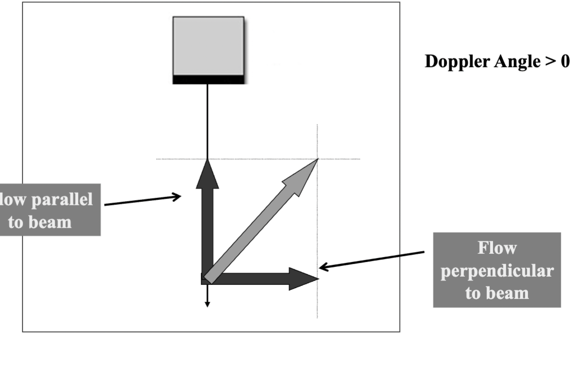 <p><span>What is the </span><strong>Doppler angle</strong><span>, and how does it influence Doppler shift measurements in ultrasound?</span></p>