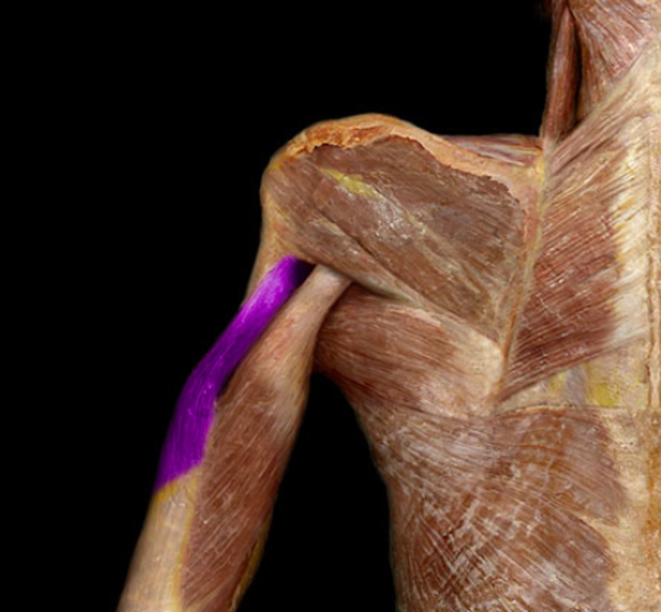 <p>O: Posterior humerus, superior and lateral to the radial groove</p><p>I: olecranon process of ulna</p><p>A: extend elbow and shoulder</p><p>N: radial</p>