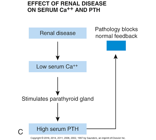 Secondary to renal failure. 