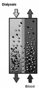 <p><span>Perfusion of blood and dialysate on opposite sides of a semipermeable membrane</span></p><p><span>N2 waste products and uremic toxins move from blood to dialysate for removal</span></p>
