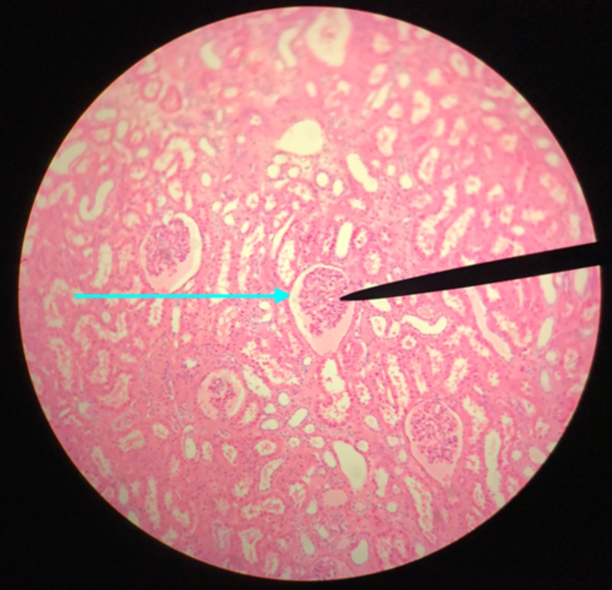 <p>What structure of the kidney is the blue arrow pointing at?</p>
