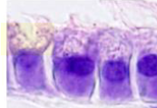 <p>Apocrina. (Gl. mamaria)</p>