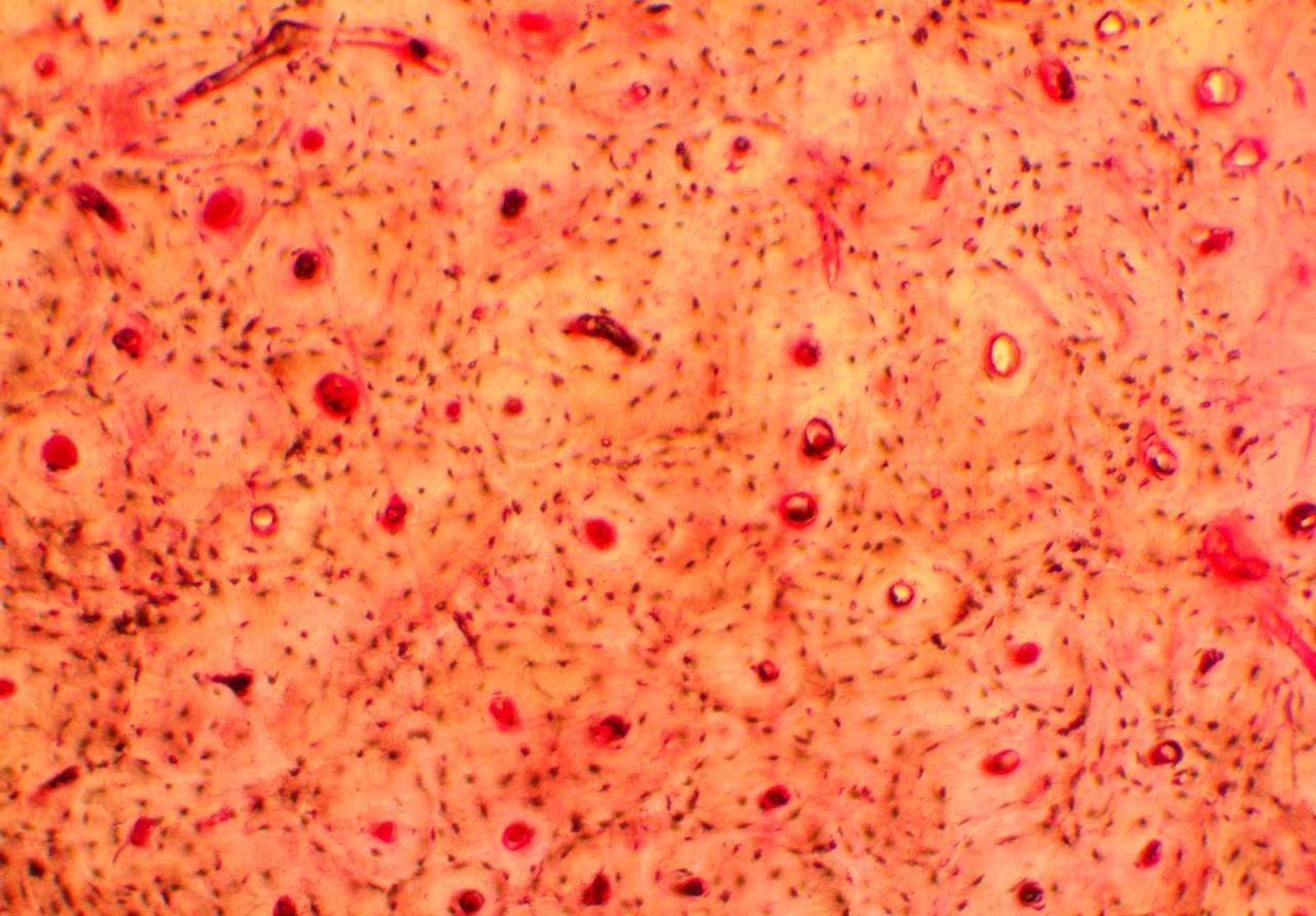<p><span>Found in all bones of the axial and appendicular skeleton</span></p>