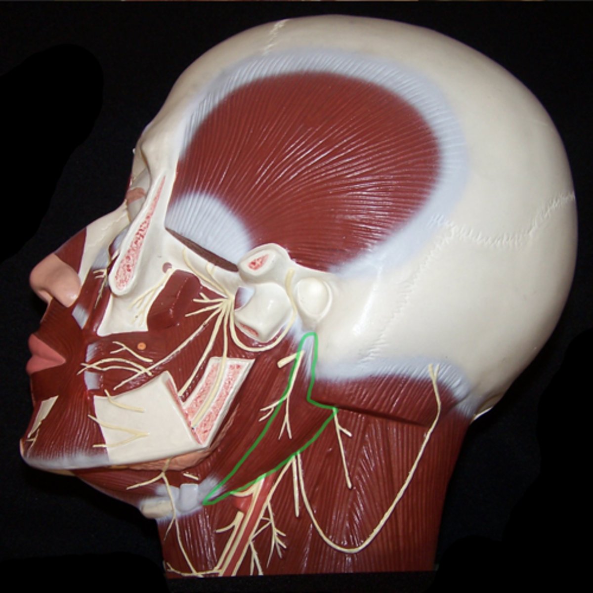 <p>(lateral) from hyoid to mastoid process; back/below.</p><p>Origin: Mastoid Process</p><p>Insertion: Hyoid Bone</p>