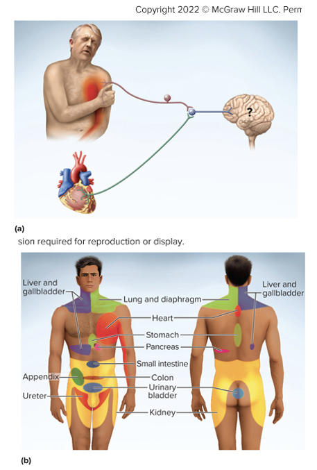 <ul><li><p>Referred pain</p></li><li><p>Phantom pain</p></li><li><p>Chronic pain</p></li></ul><p></p>