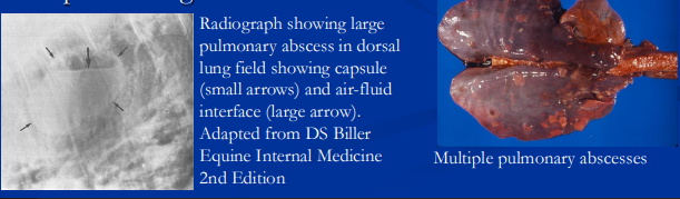 <p><span>Bacterial Pneumonia</span></p>