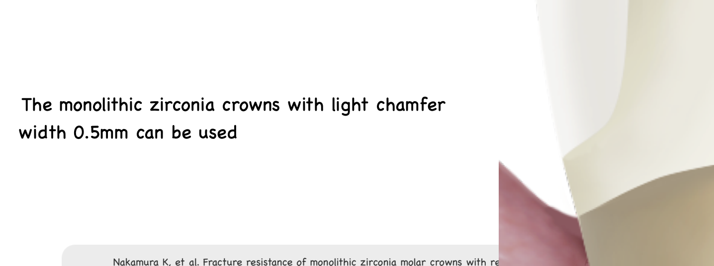 <p>light chamfer .5 mm </p>