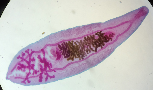 <p>What kind of figure is this? What is the brown part?&nbsp;</p>