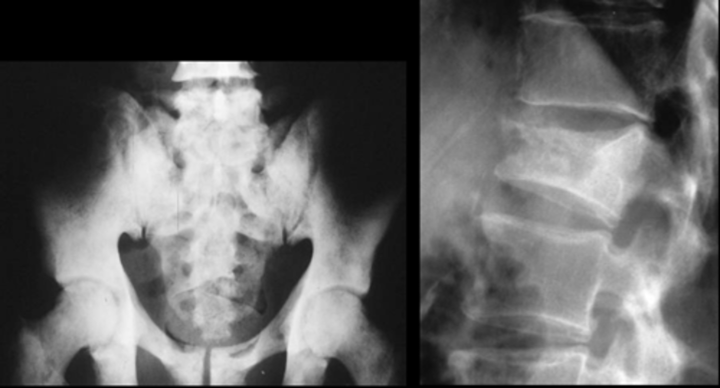 <p>Diagnosis?</p>