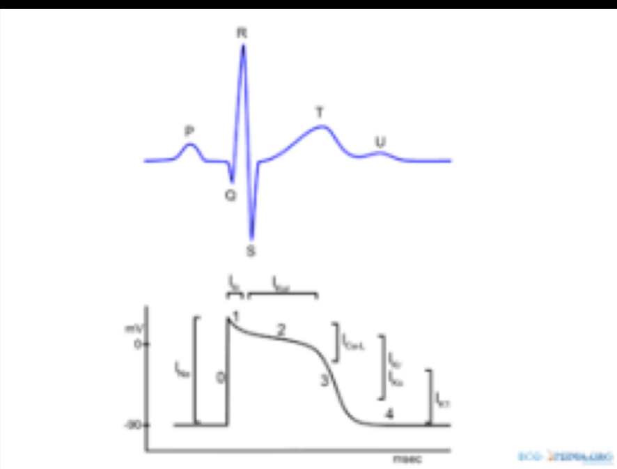 <p><span style="color: rgb(39, 53, 64)">One of these images is a pacemaker potential in the SA node.</span></p><p><span style="color: rgb(39, 53, 64)">True or false</span></p>