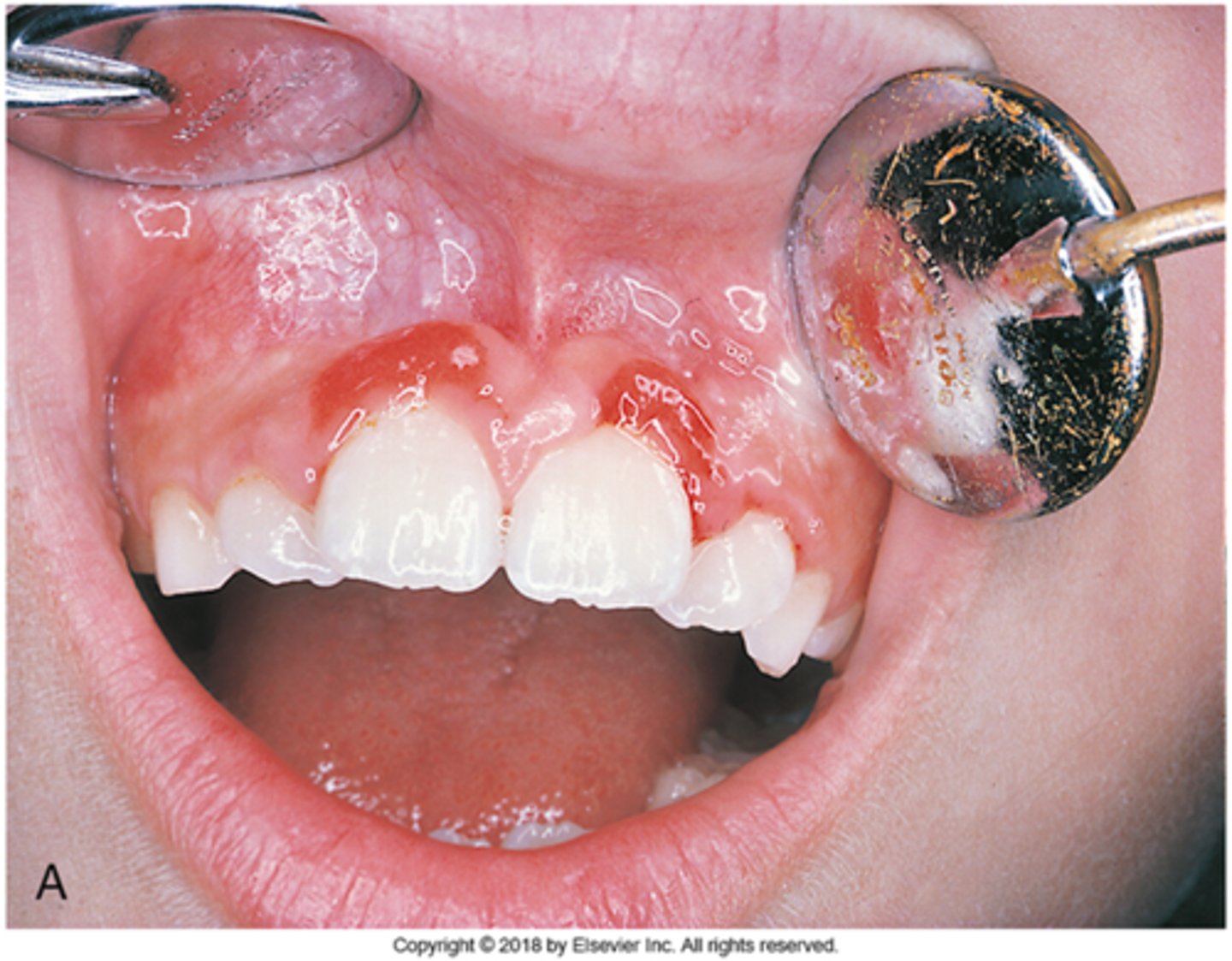 knowt flashcard image