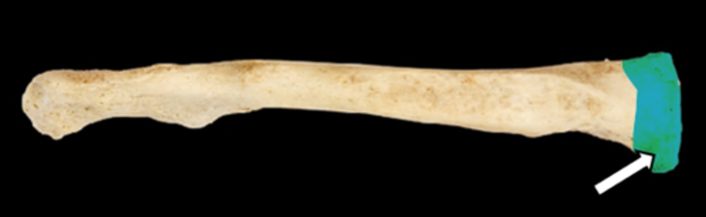 <p>name the part</p>