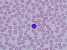 <p>Appearance: Large spherical nucleus, no visible granules</p><p>Function: Direct cell attack via antibodies</p>