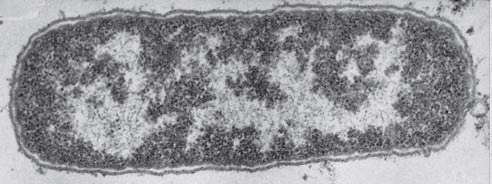 Electron microscopy of e coli longtitudinal section.