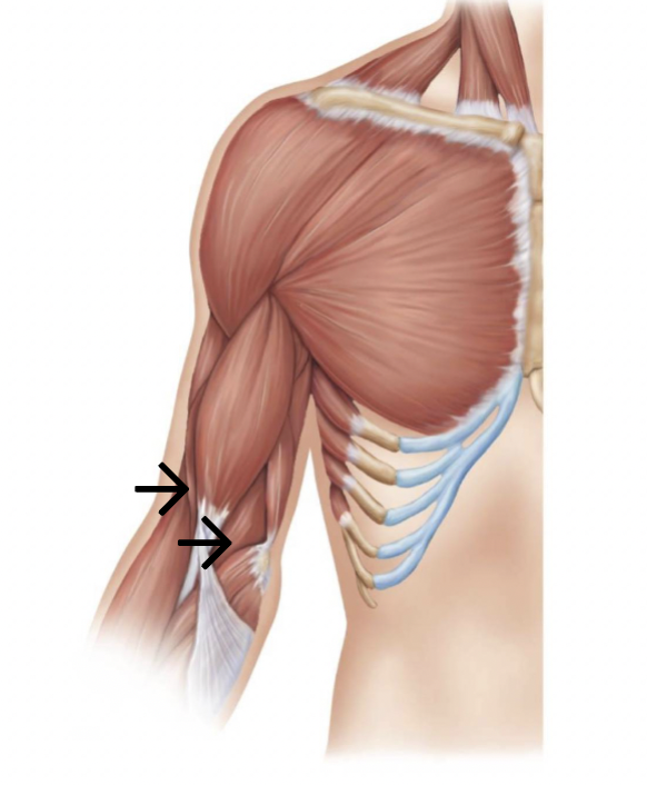 <p>ID muscle</p>