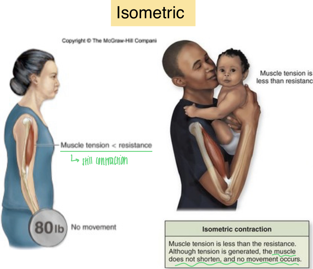 <p>-muscle is working, but holding a pose (planks or yoga)</p><ul><li><p>muscle does NOT change length</p></li><li><p>muscle tension is LESS than resistance</p></li><li><p>muscle can&apos;t shorten because the load is too great</p></li><li><p>still contracting but no movement occurs</p></li></ul>