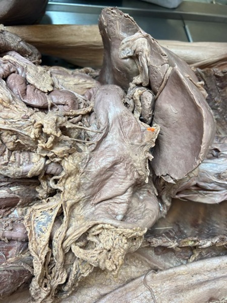 <p>lesser omentum</p>