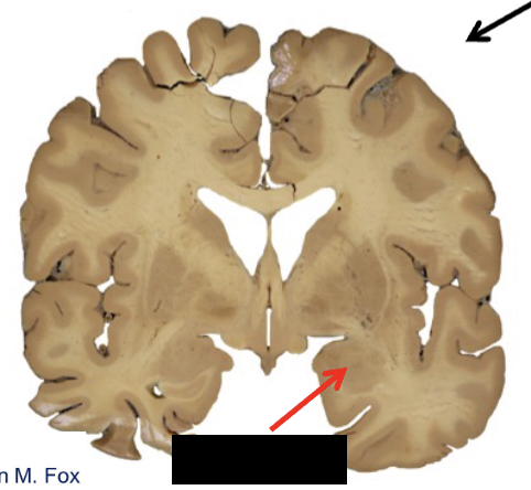 <p><strong>limbic system</strong></p><ul><li><p>what structure is this?</p></li></ul><p></p>