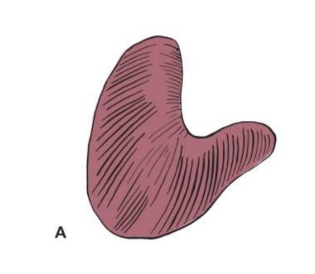 What type of placenta is this?