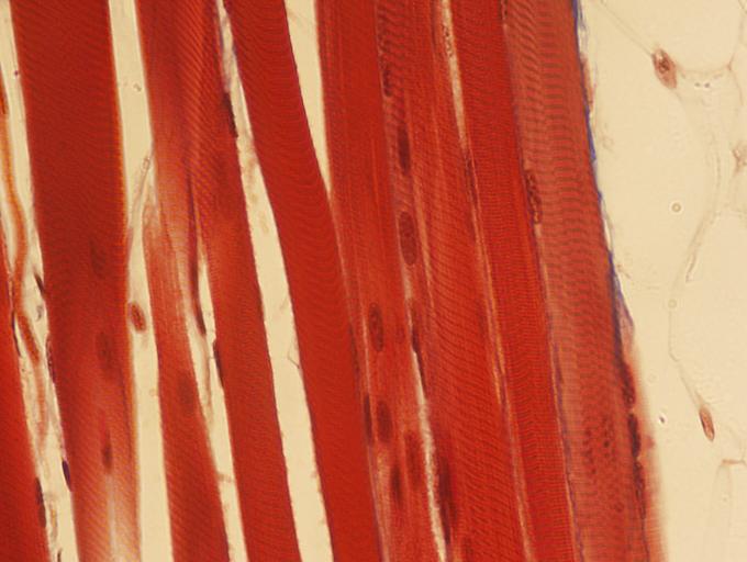 <p><span style="font-family: Lato Extended, Lato, Helvetica Neue, Helvetica, Arial, sans-serif">Identify the type of muscle tissue shown?</span></p>