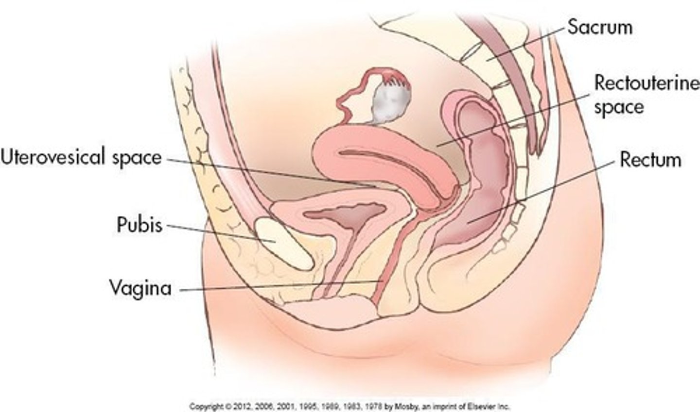 <p>The space within the true pelvis, occupied by various organs.</p>