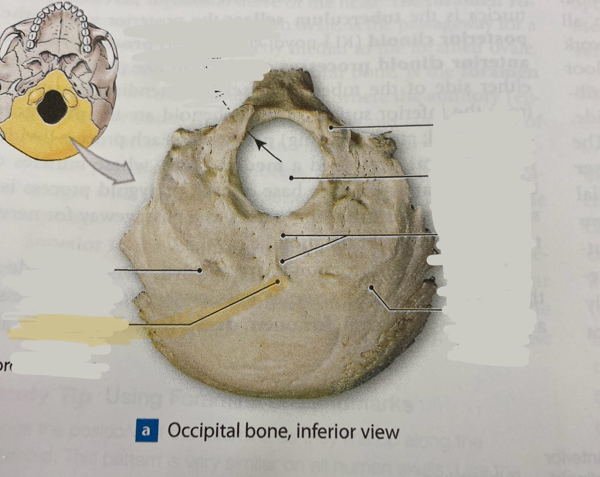 <p>what structure is this?</p>