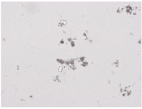 <p>Ammonium urate, struvite, and bacteria</p>
