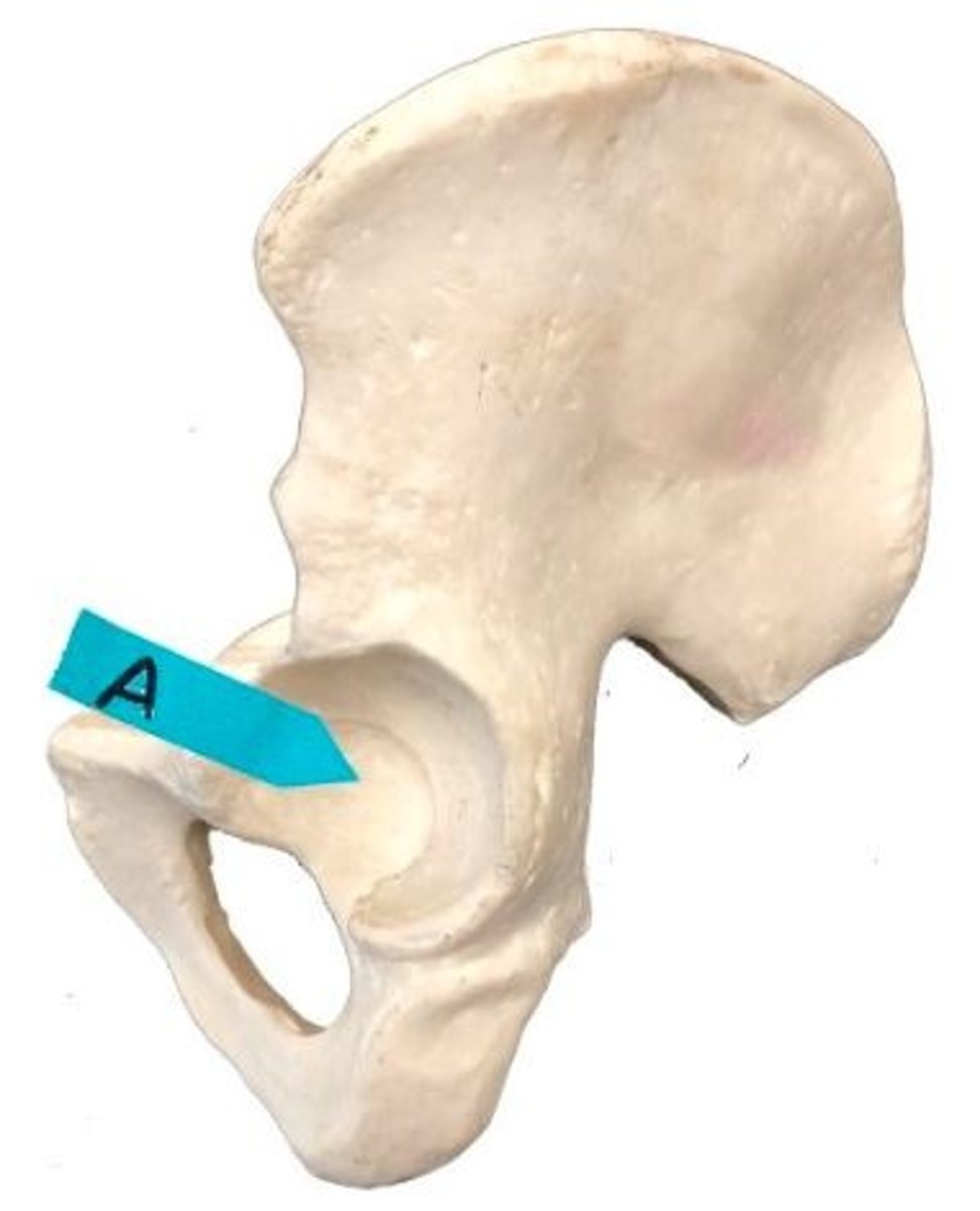 <p>Identify this bone marking.</p>