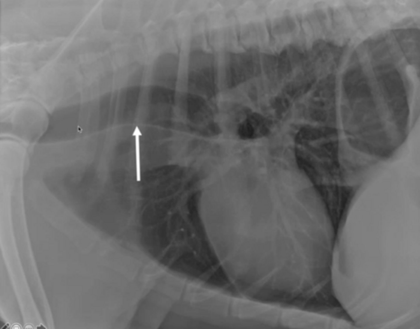 <p>The arrow is pointing to what appears to be a pathology, but what is it really?</p>