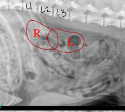 <p>Normal Abdomen Kidneys on Radiographs </p>