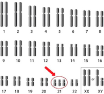 <p>(K3) Was ist das für eine Genommutation?</p>