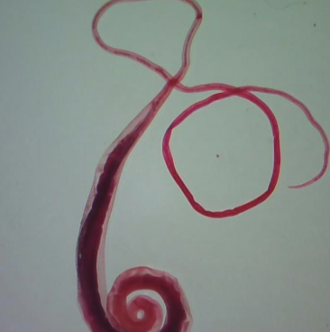 <img src="https://knowt-user-attachments.s3.amazonaws.com/63da89d5-00e1-453a-843e-70981a9ca5c9.png" data-width="100%" data-align="center"><p>Adenophorea</p>