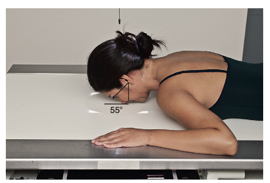 <p>Special: What is the <u>positioning</u> of <strong>Modified Parietocanthial projection: Modified waters method </strong>for <strong>facial bone</strong>?</p>