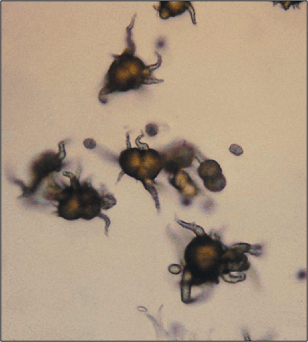 <p>seen with liver disease</p>