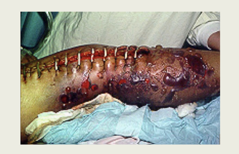 What infection is this?
